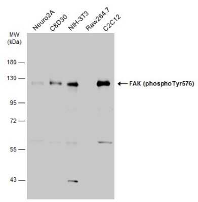 Western Blot: FAK [p Tyr576] Antibody [NBP3-13071]